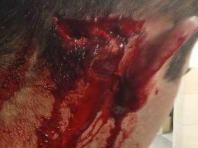 Detenidos por tentativa de homicidio los presuntos autores de la brutal paliza a un vecino de Bueu durante una pelea en la Avenida de Marín de Cangas