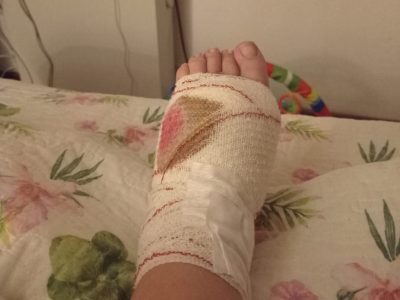 Tania, vecina de Cangas mordida por un pitbull en Rodeira: “Si le pasa a un niño lo mata”